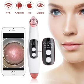 Visible Camera Blackhead Remover Vacuum Suction